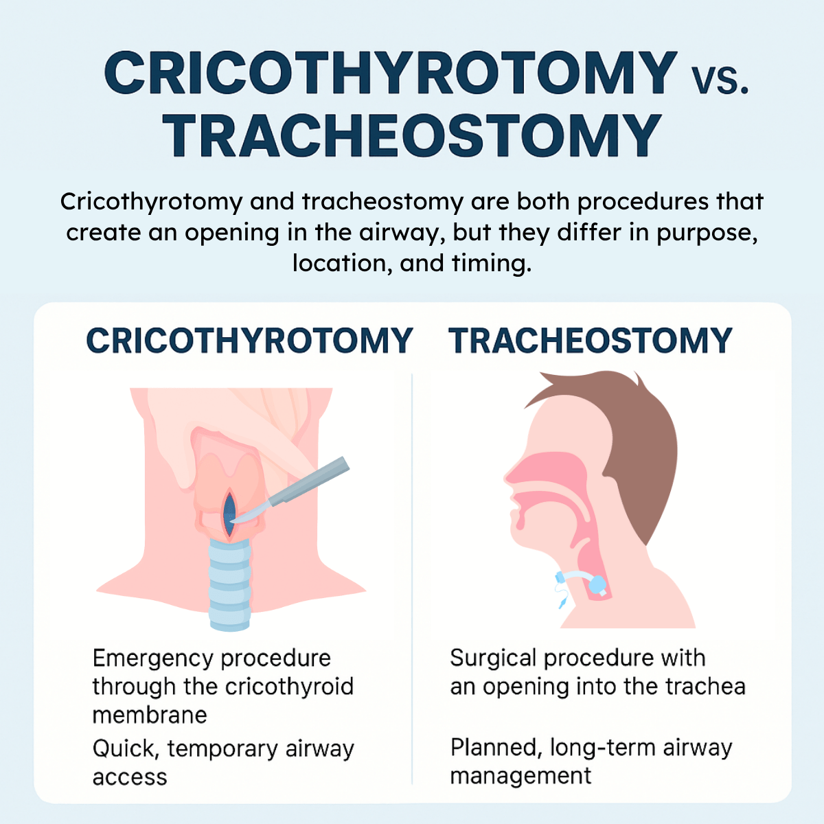 Cricothyrotomy vs Tracheostomy Illustration Infographic