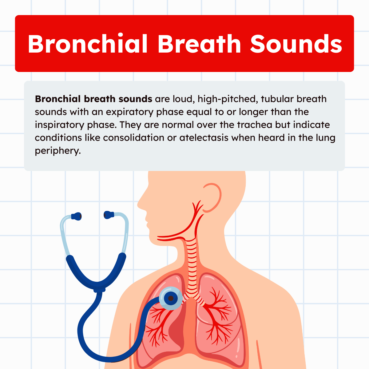 Bronchial Breath Sounds: Overview and Practice Questions