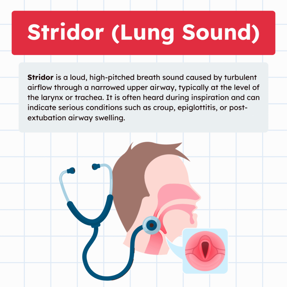 Stridor (Lung Sound): Overview and Practice Questions (2026)