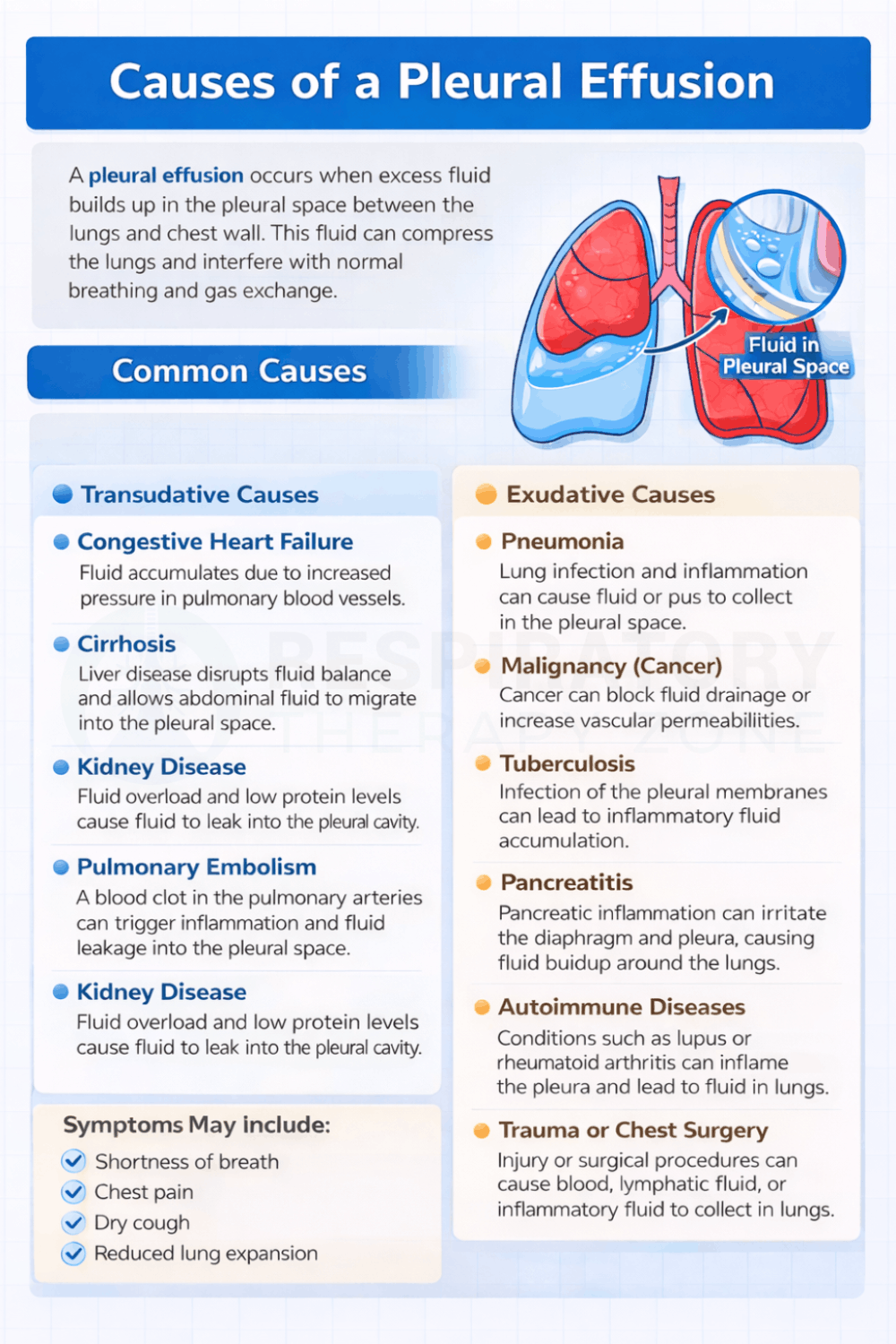Top 10 Causes Of A Pleural Effusion 2026 