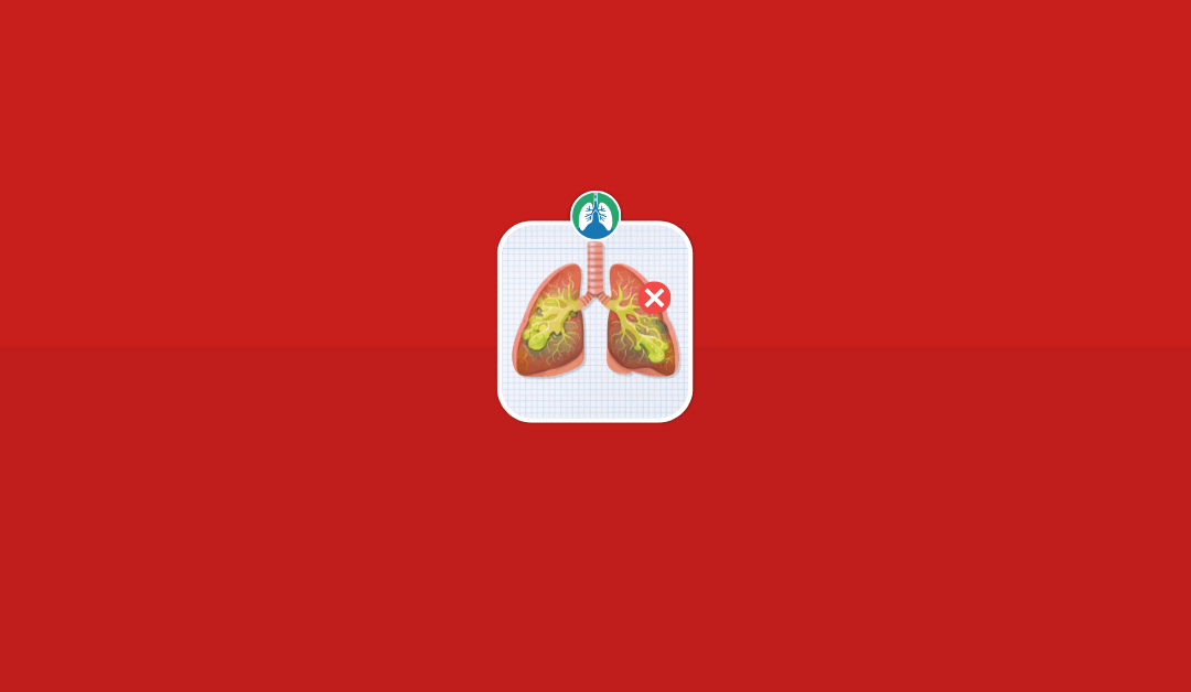 Foods That Cause Mucus: What to Avoid to Reduce Buildup