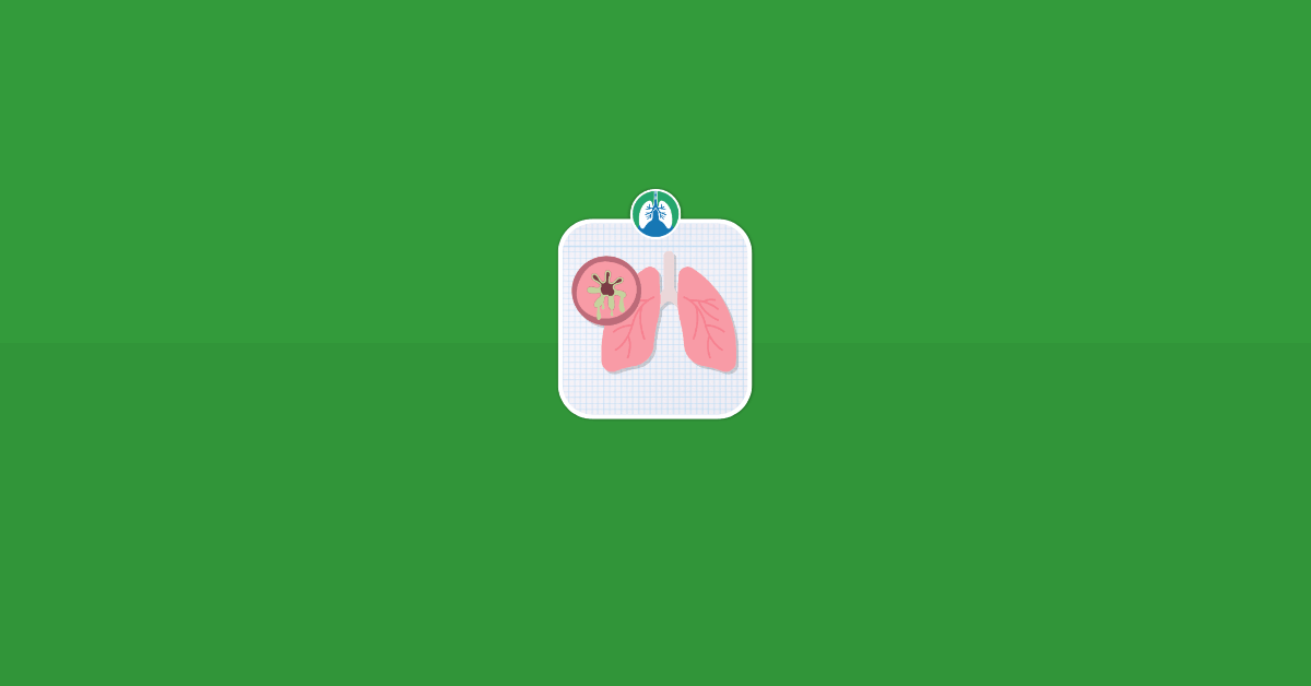 Bronchiectasis Illustration Vector Image