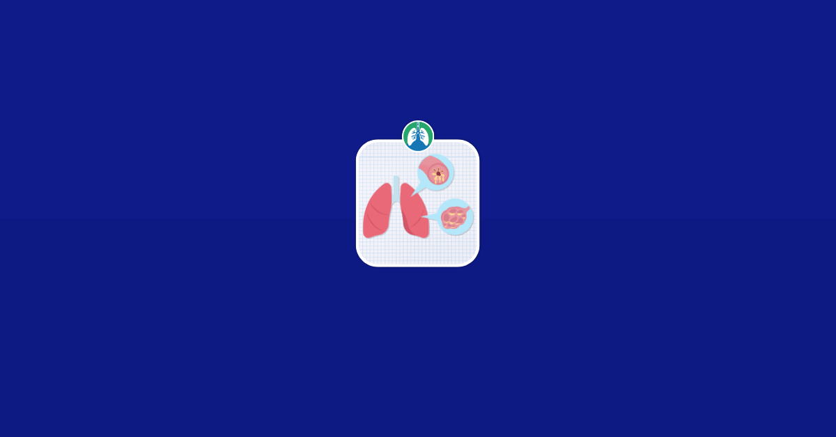 COPD in Respiratory Care Vector COPD in Respiratory Care Vector