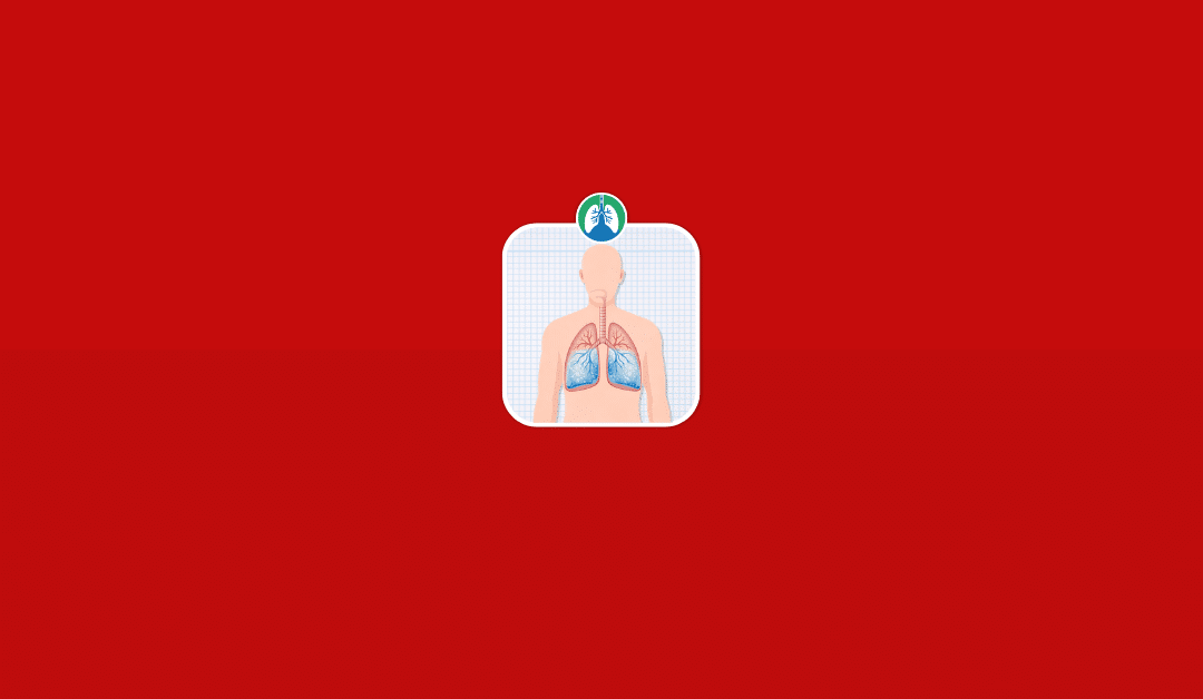 How Serious Is Fluid in the Lungs? (2026)