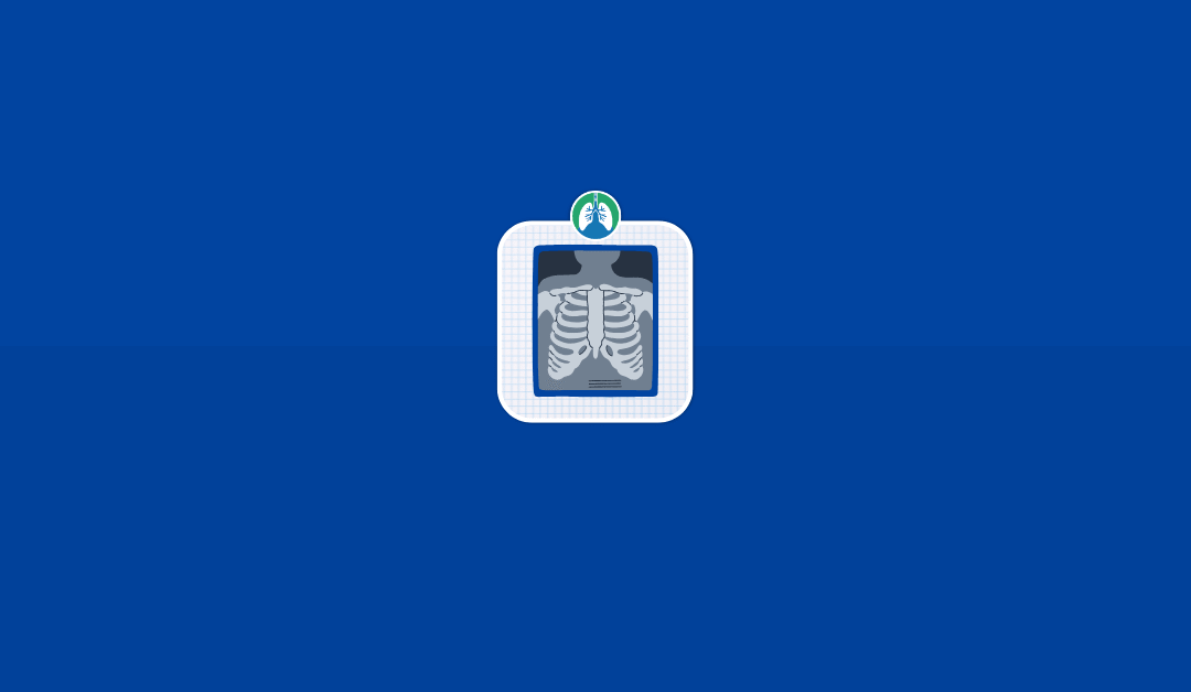 Radiographic Findings: Key Signs in Respiratory Care