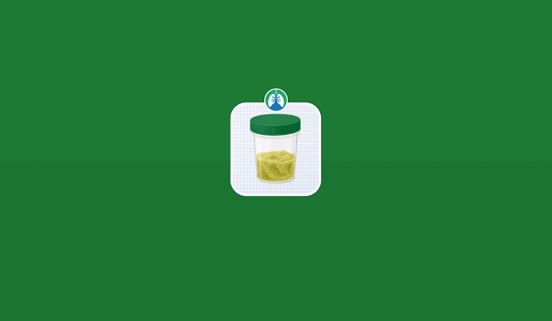 Sputum Evaluation: Color, Consistency, Odor, and Volume