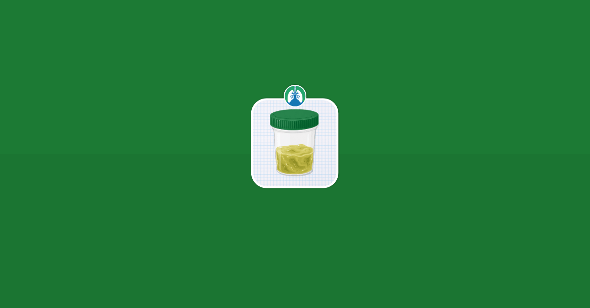 Sputum Evaluation Illustration Vector