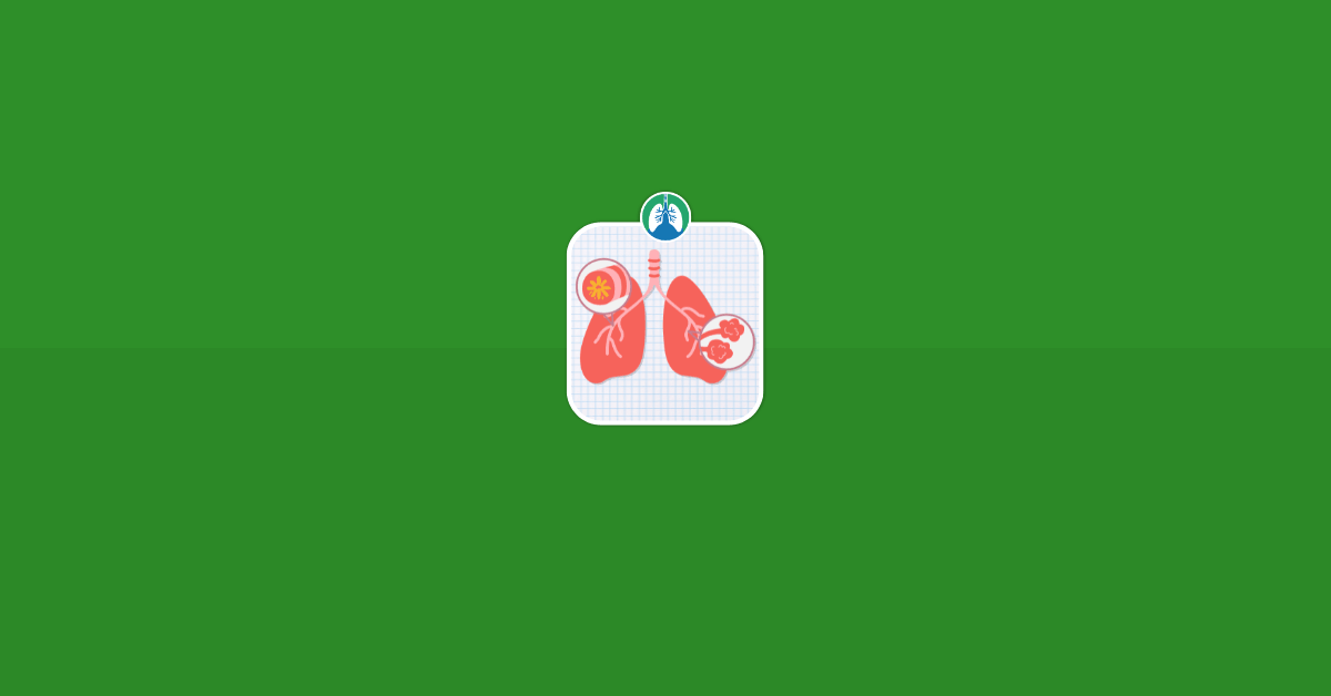 Cystic Fibrosis Lungs Vector