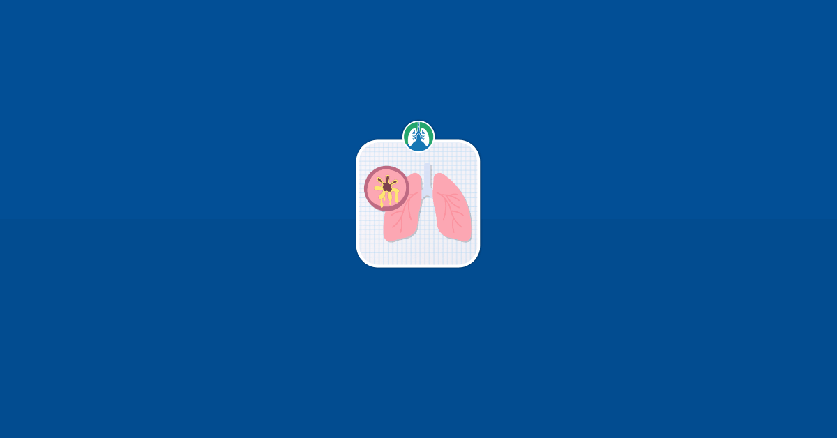 Bronchiectasis vs. Bronchitis Illustration Vector