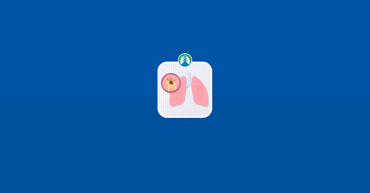 Bronchiectasis vs. COPD Illustration Vector Bronchiectasis vs. COPD Illustration Vector