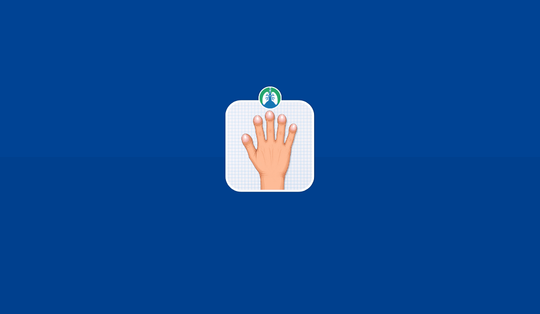 Digital Clubbing: Causes, Signs, and Clinical Meaning