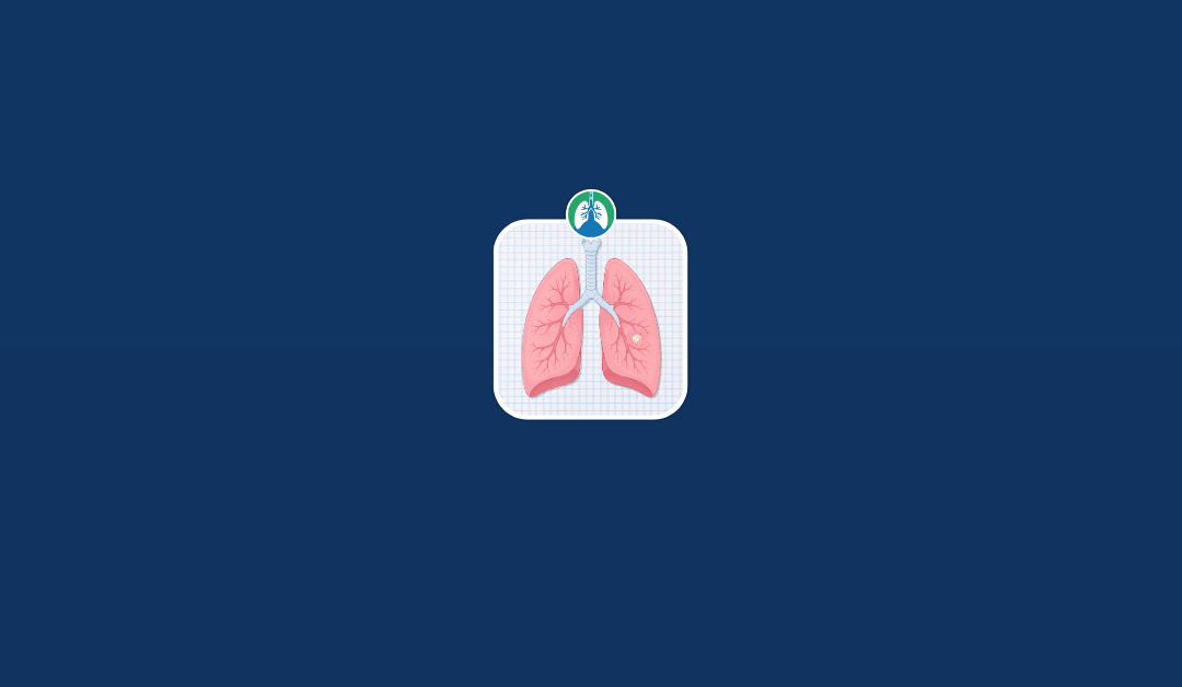Can Lung Nodules Go Away on Their Own?