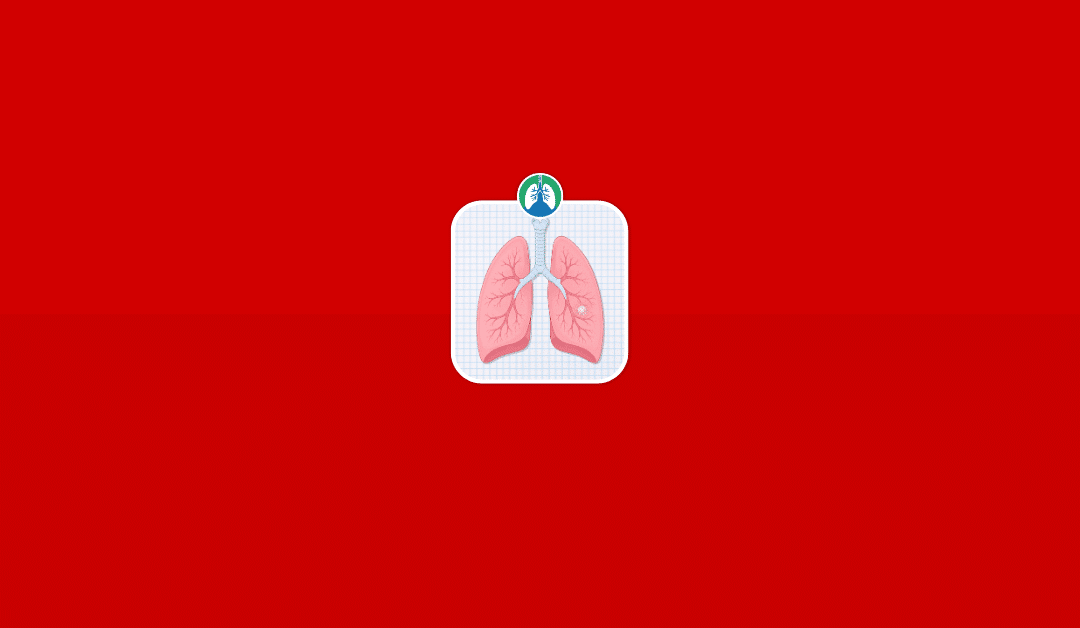 Ground Glass Lung Nodule: Causes, Risks, and Treatment