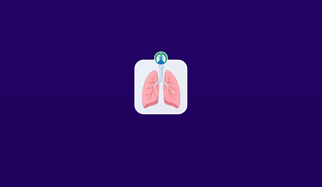 Lung Nodule Removal: What to Know Before, During, and After