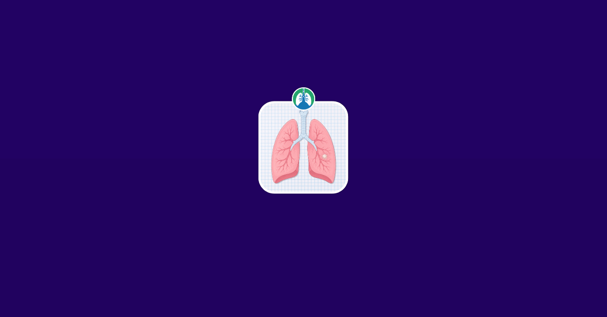 Lung Nodule Removal- What to Know Before, During, and After Illustration Vector Lung Nodule Removal- What to Know Before, During, and After Illustration Vector