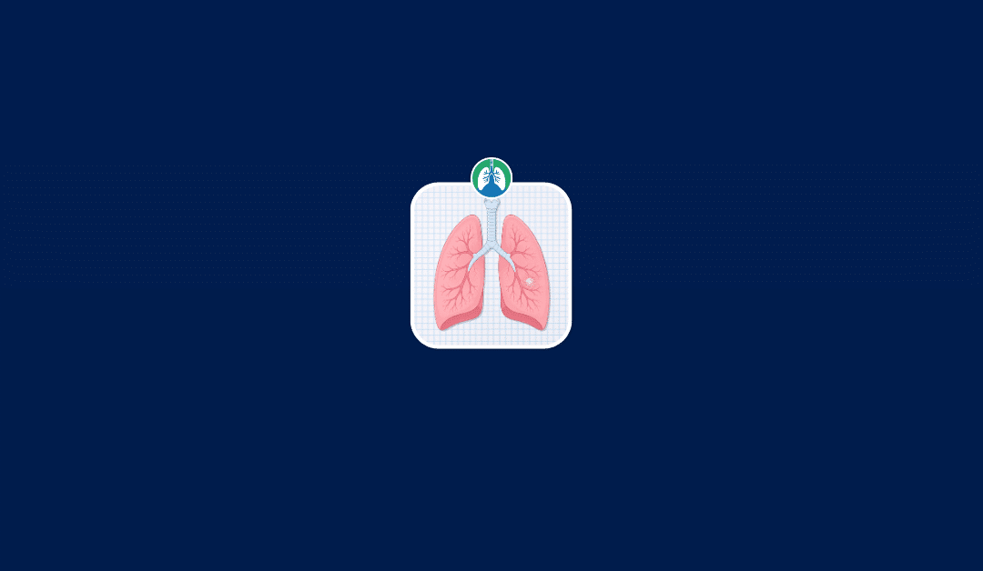 Lung Nodule Size Chart: What Different Sizes May Mean