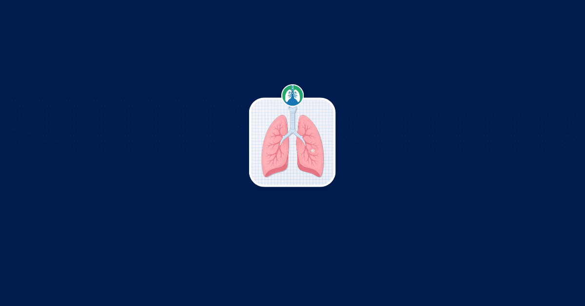 Lung Nodule Size Chart Illustration Vector Lung Nodule Size Chart Illustration Vector