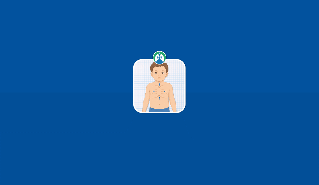 Retractions: Causes, Types, Assessment, and Treatment