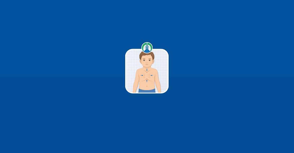 Retractions- Causes, Types, Assessment, and Treatment Vector Retractions- Causes, Types, Assessment, and Treatment Vector