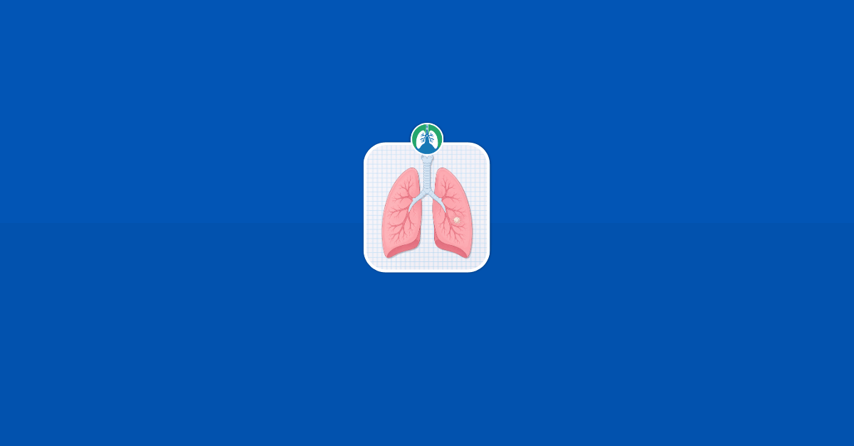 Spiculated Lung Nodule Vector Image Spiculated Lung Nodule Vector Image
