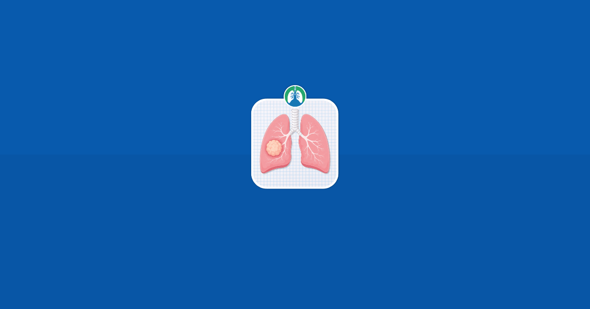 Lung Mass Illustration Vector Image