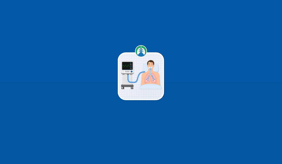 Pressure Support Ventilation (PSV): A Complete Guide